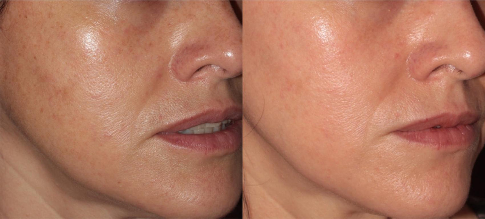 From Dull, Tired Skin to